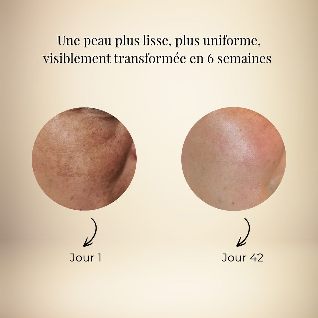 Crème Correctrice Anti-Taches à l'Oliban Royal – Olibrigh® (50 ml)