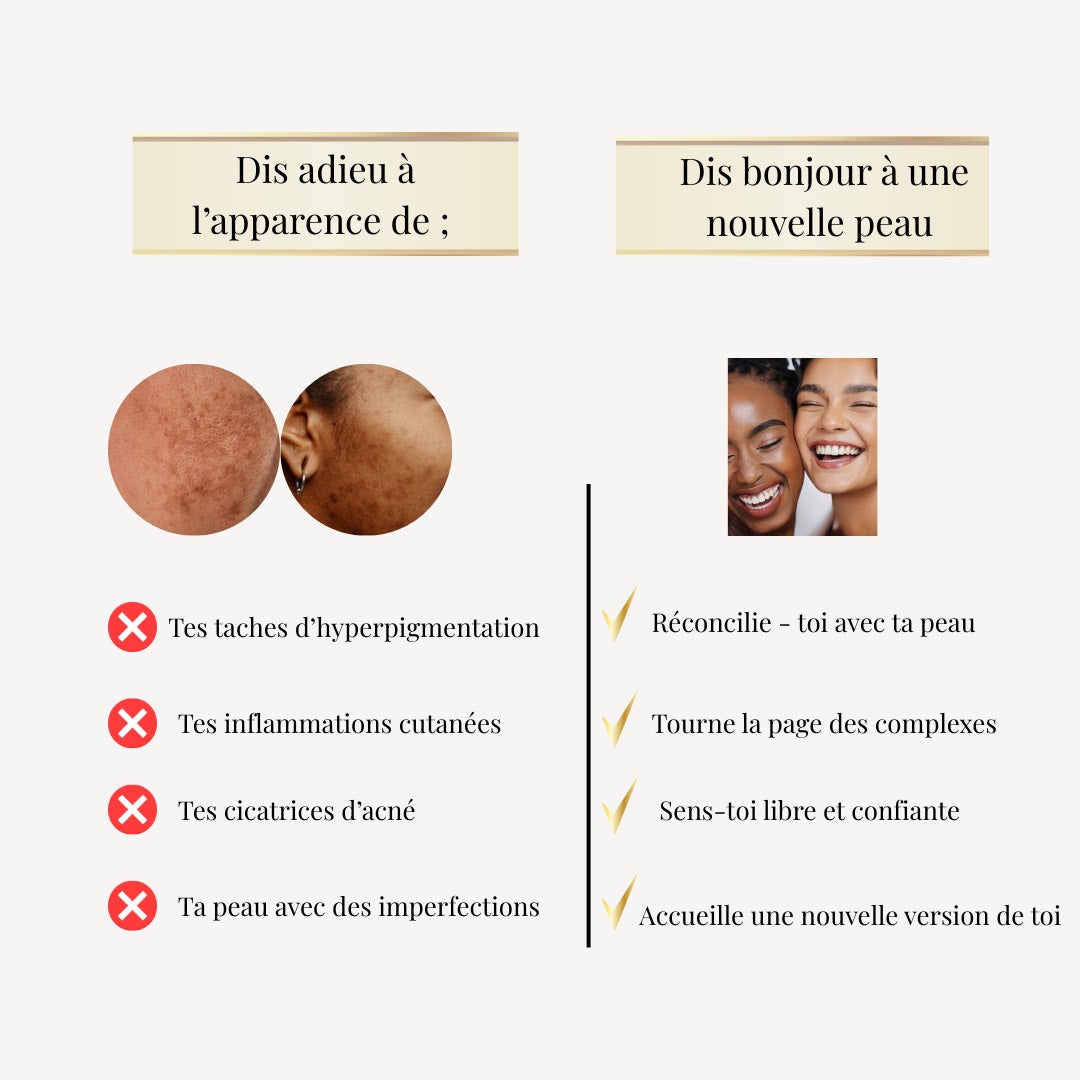 Crème Correctrice Anti-Taches à l'Oliban Royal – Olibrigh® (50 ml)